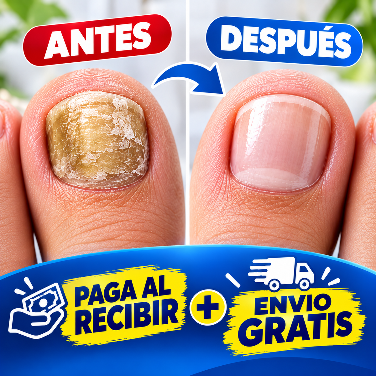 NailReset™ Parche Antifúngico para Hongos